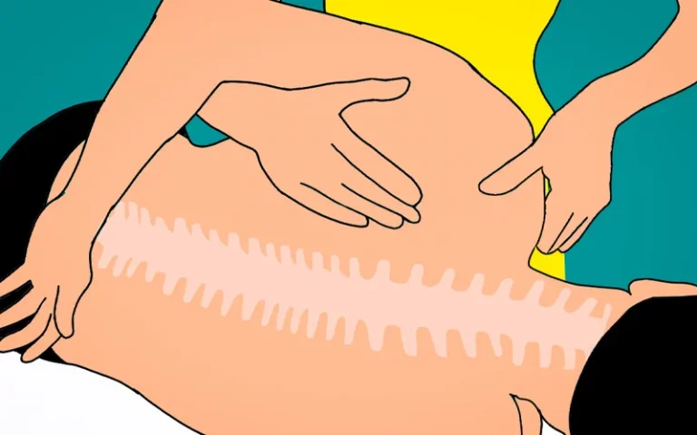 Common Misconceptions About Chiropractic Care